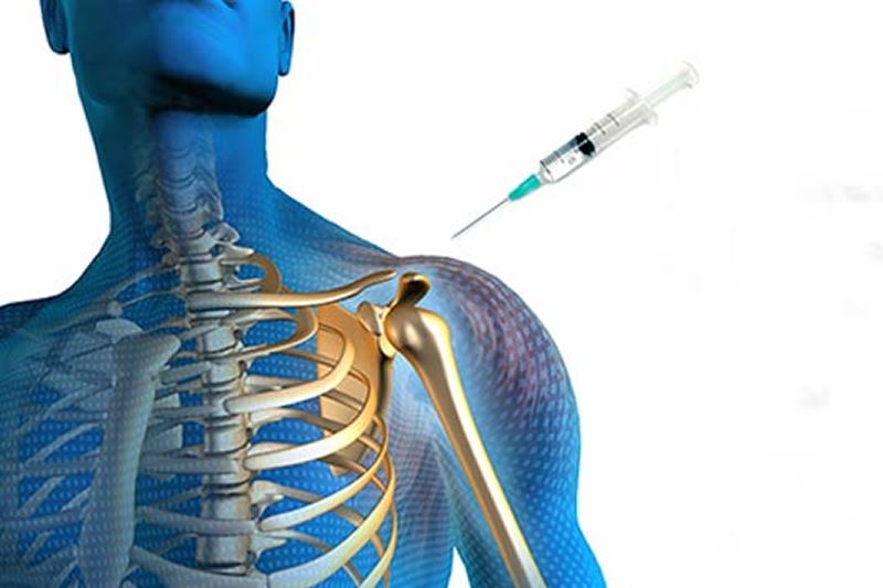 Sakarya Proloterapi | Alternatif Klinik