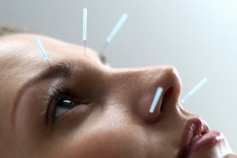 Sakarya Akupunktur | Doktor Bülent Hazer